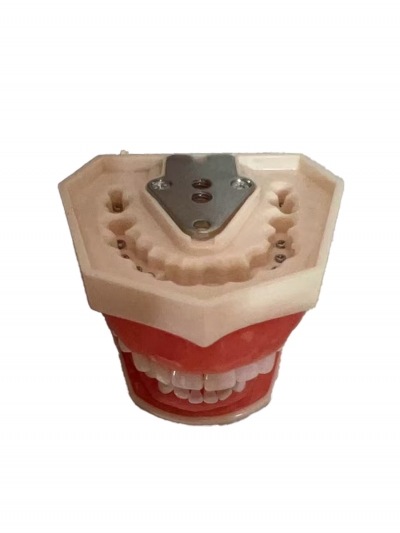 Стоматологическая модель челюсти со съемными зубами 32Dent-3